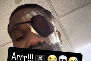 海盗造型！艾顿IG晒自拍 左眼已被包扎并戴上眼罩保护